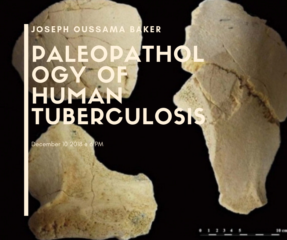 Paleopathology of human tuberculosis: review and focus on the hypothetical oldest evidence on the Homo erectus from Turkey